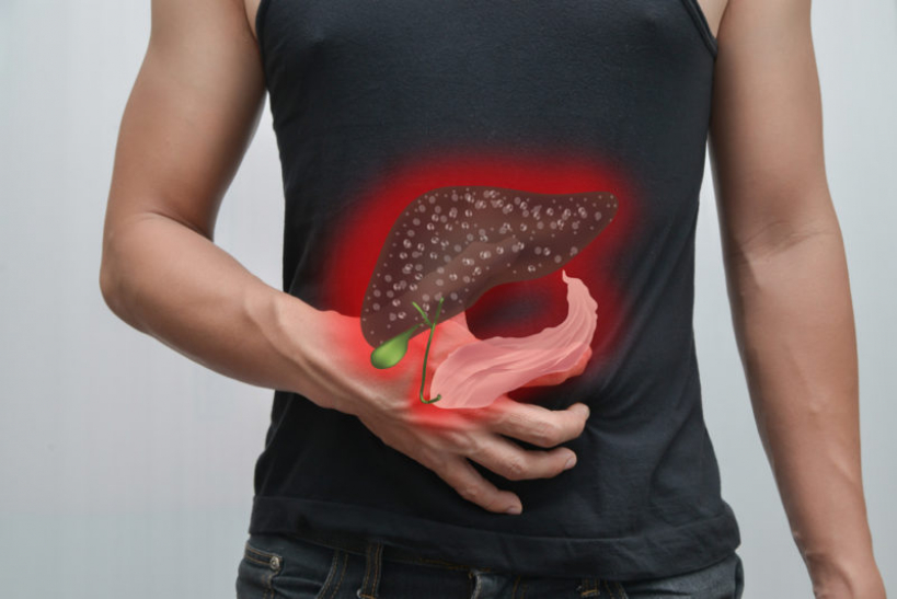 5 Semne tăcute ale ficatului gras și cum să-l faci din nou sănătos cu aceste remedii naturale