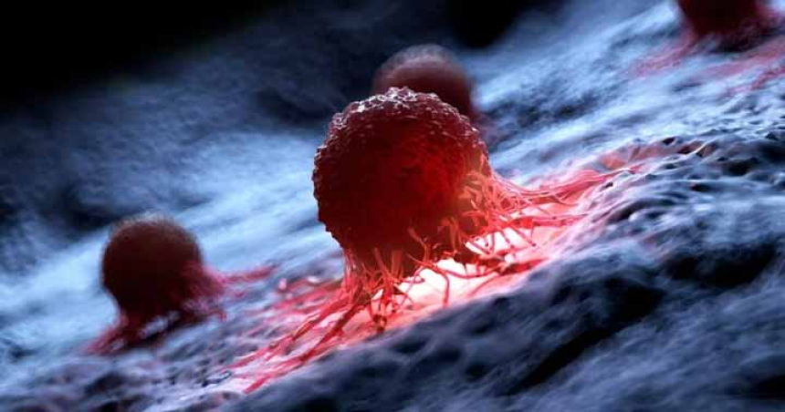 Cercetătorii au distrus 99% din celulele canceroase în laborator cu ajutorul unor molecule care vibrează
