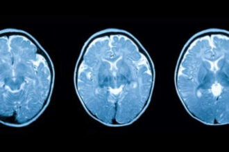 De ce generațiile mai tinere au creierul mai mare. Care sunt efectele? Este acest lucru mai sănătos?
